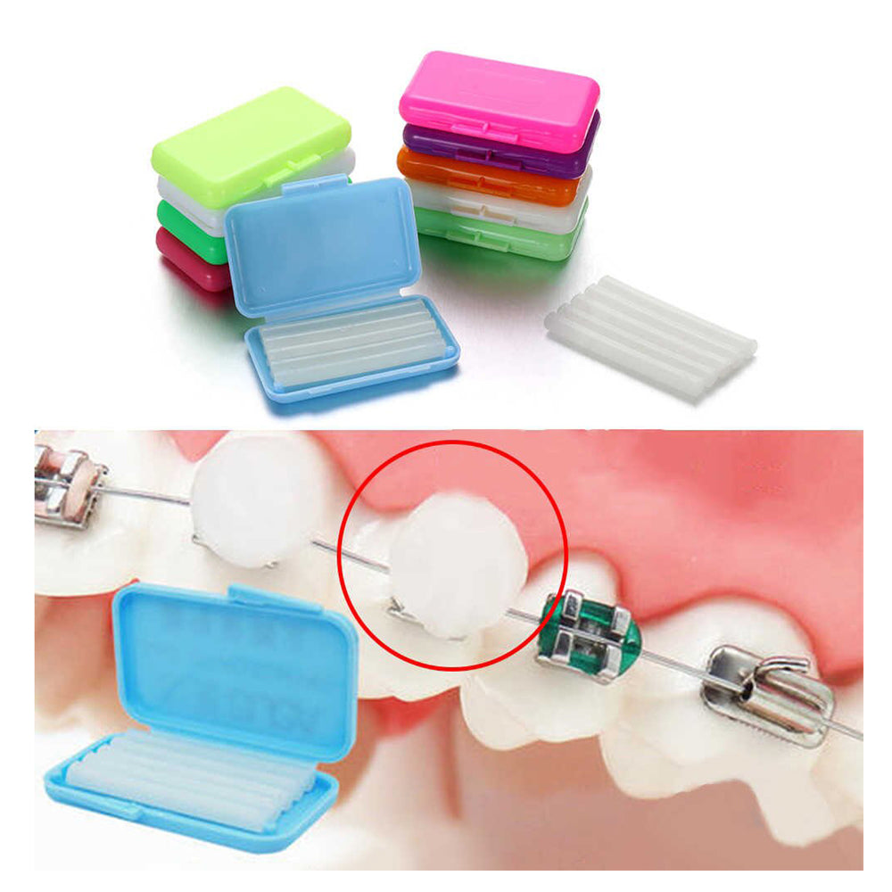 Ortho Wax for Braces Comfort and Protection