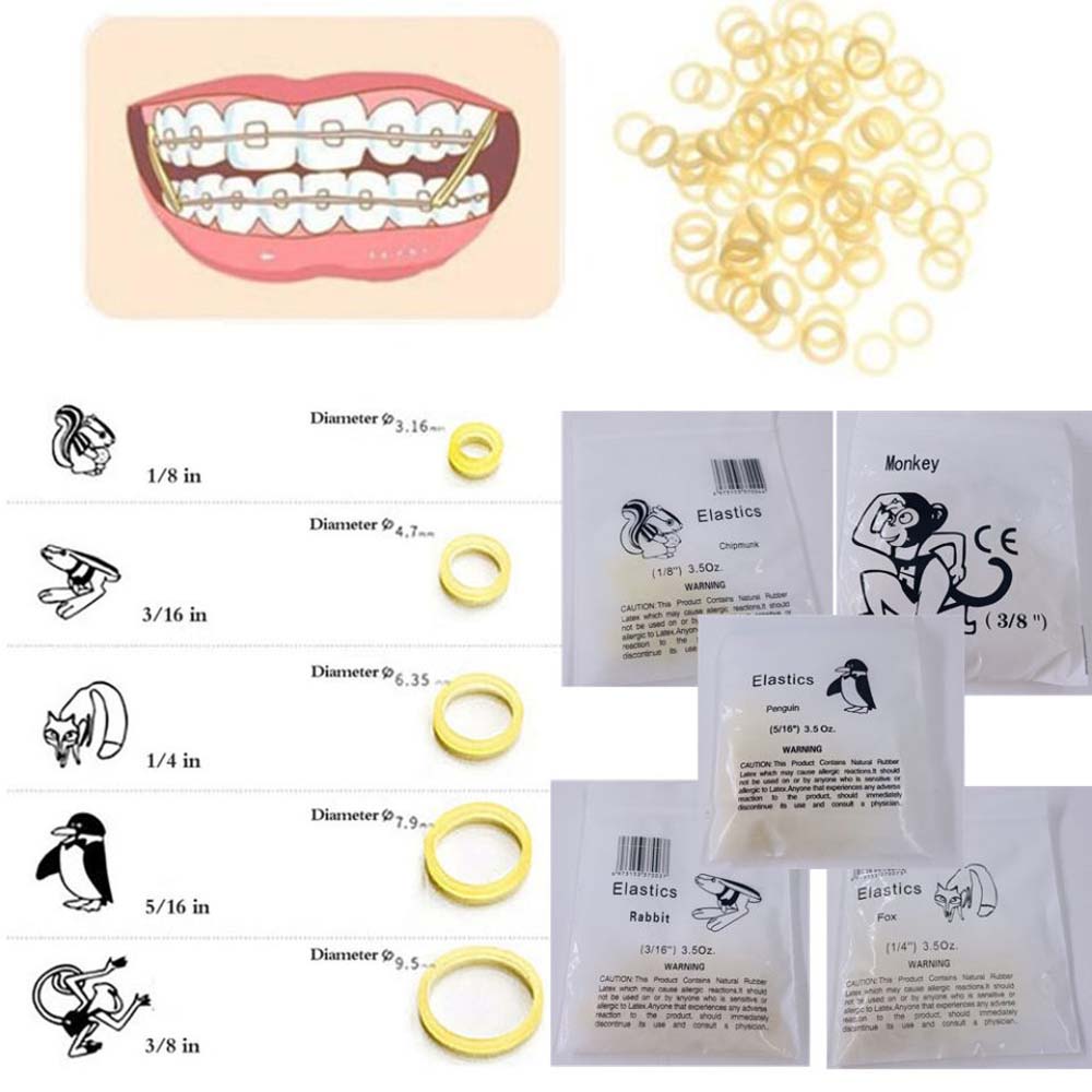 Orthodontic Elastics