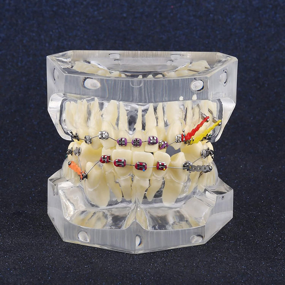 Orthodontic Study Teeth Model Wire Chain