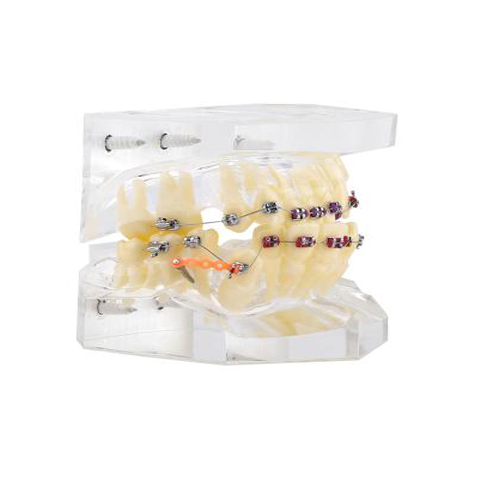 Orthodontic Study Teeth Model Wire Chain